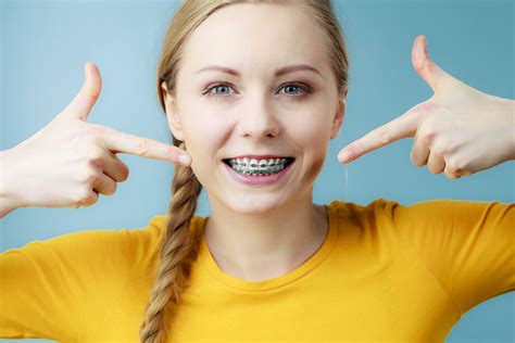 Turn Heads with Your Magical Smile: The Benefits of Magic Smile Teeth Braces